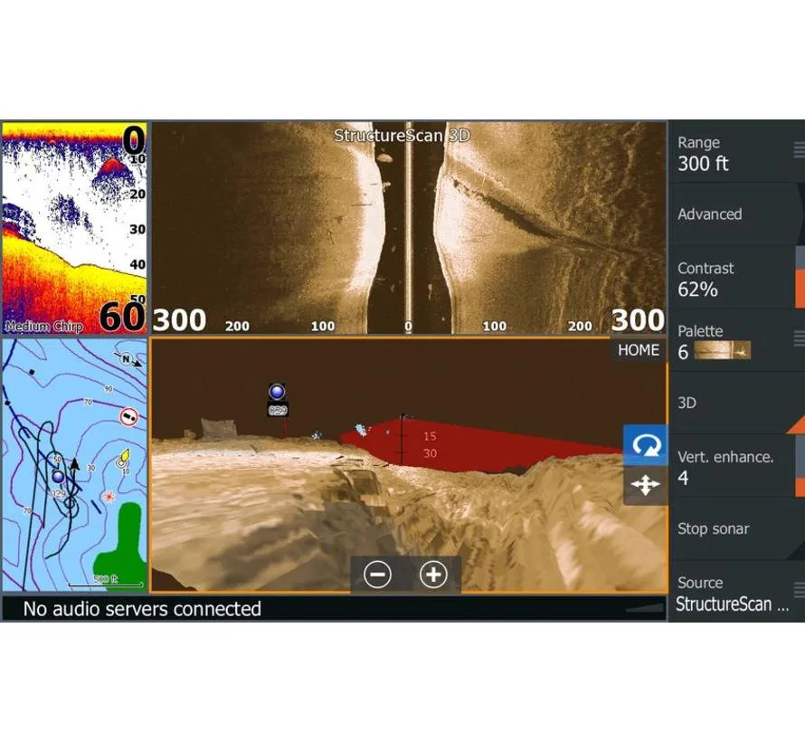 Structurescan 3D XDCR, Module und transducer