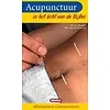 Acupunctuur- in het licht van de Bijbel
